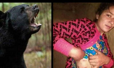 Bear Attack In Uttarakhand : Radha fought with bear in chamoli