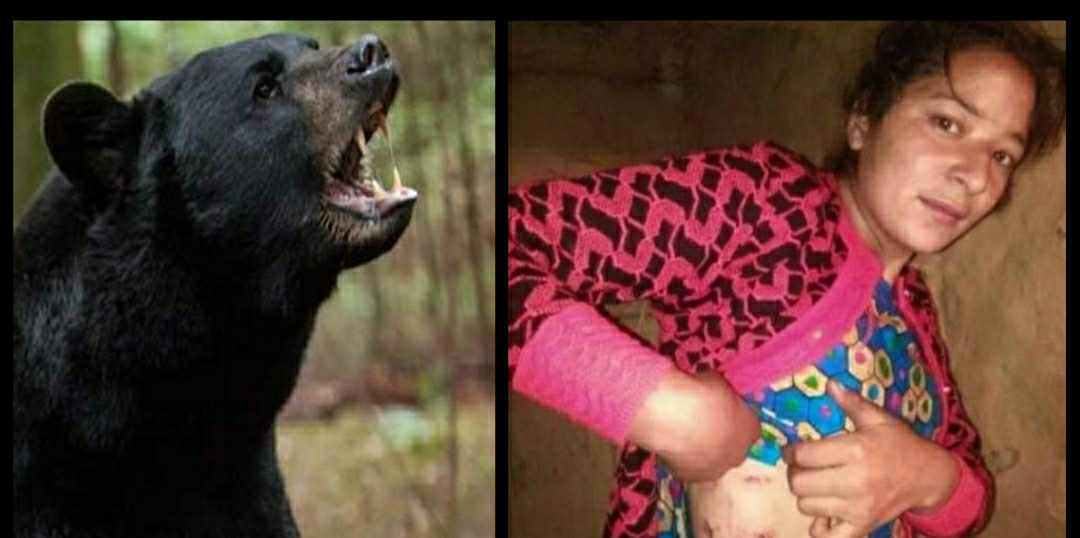 Bear Attack In Uttarakhand : Radha fought with bear in chamoli