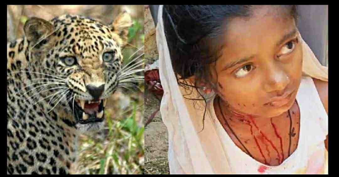 Uttarakhand : nainital leopard attack on girl