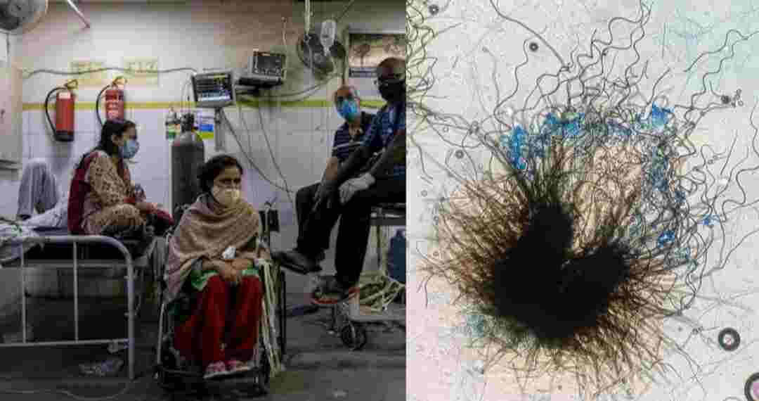 Uttarakhand News: black fungus cases rising in state total cases above 100 9 died