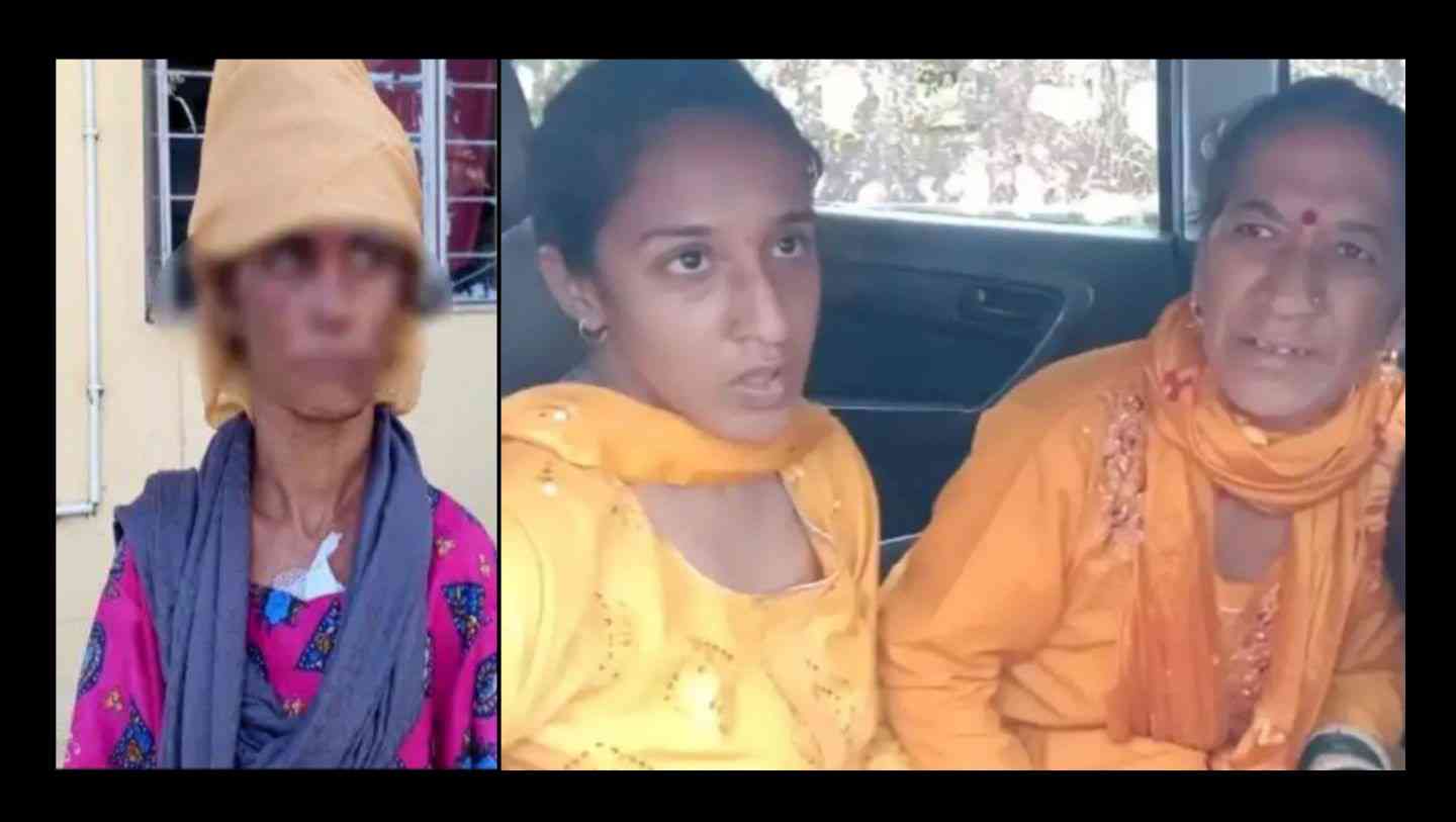 Uttarakhand:Tehri Garhwal, Mother-daughter arrested for burning daughter-in-law in dowry case