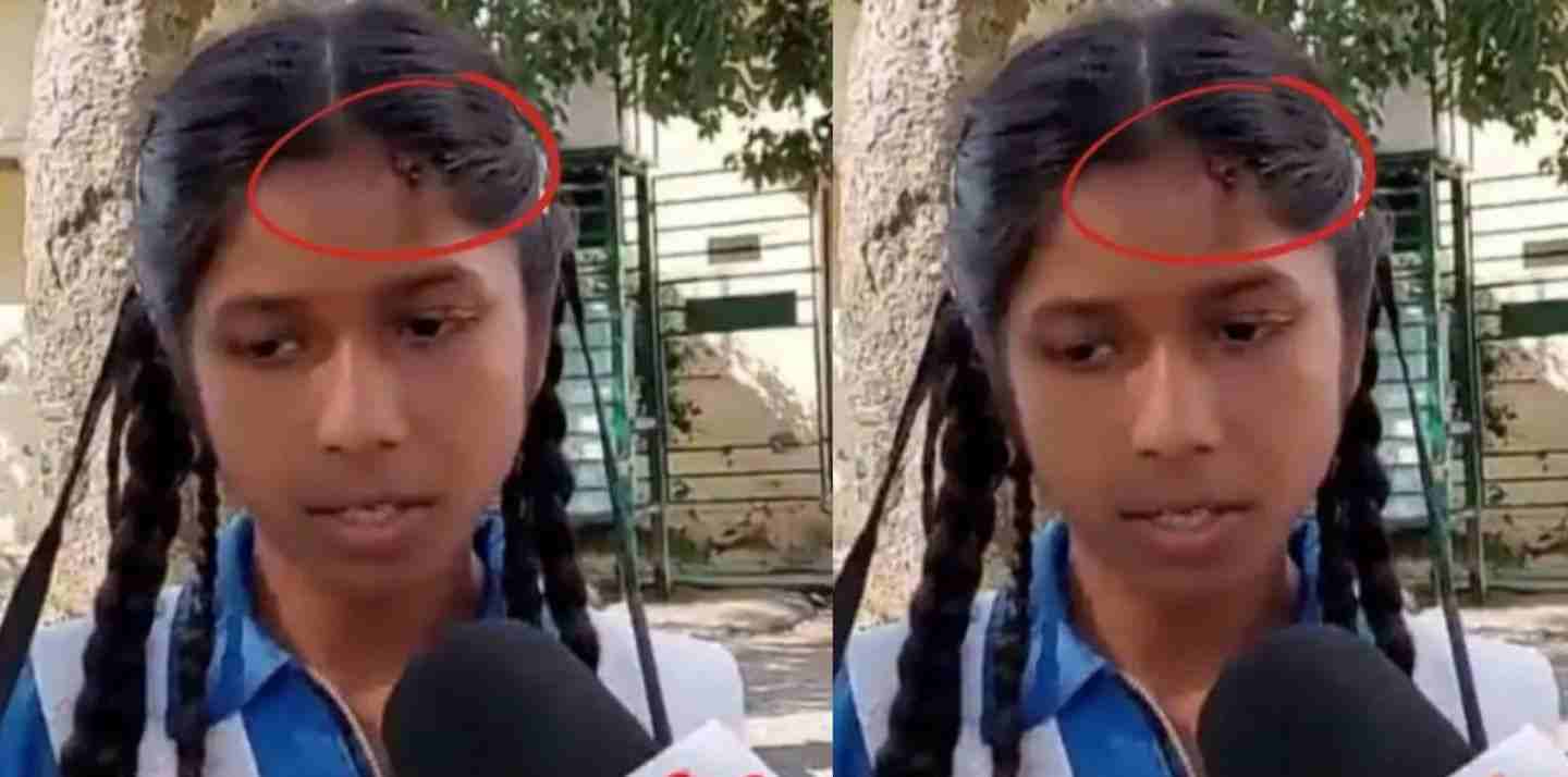 Uttarakhand news: today in Gadarpur, the teacher broke the girl's head in the middle of the class