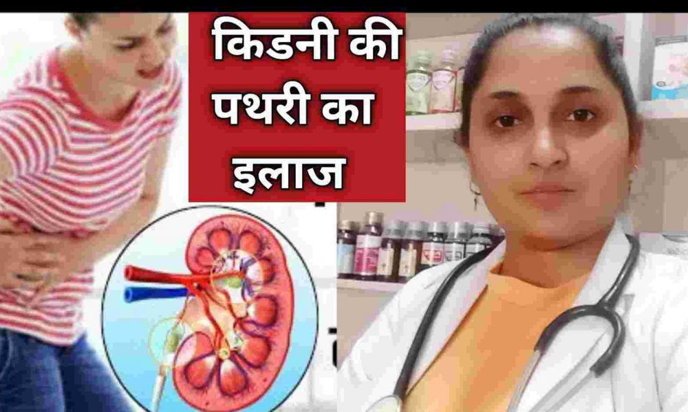 Dr. Dikshita Pandey general homeopathic physician lucknow kidney stone treatment