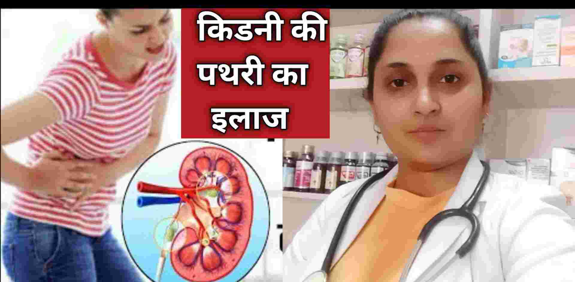 Dr. Dikshita Pandey general homeopathic physician lucknow kidney stone treatment