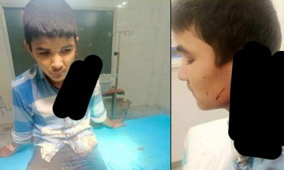 Uttarakhand News: A teenager's ear was cut off in Rudraprayag Jakholi, a case related to molestation ..