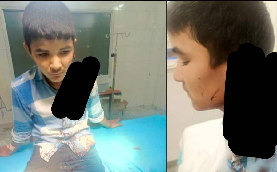 Uttarakhand News: A teenager's ear was cut off in Rudraprayag Jakholi, a case related to molestation ..