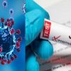 Uttarakhand news: corona virus jn1 case update today 2025