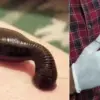 Chamoli News today: Leech came out of the nose of an 11-month-old child in karnprayag uttarakhand breaking live update