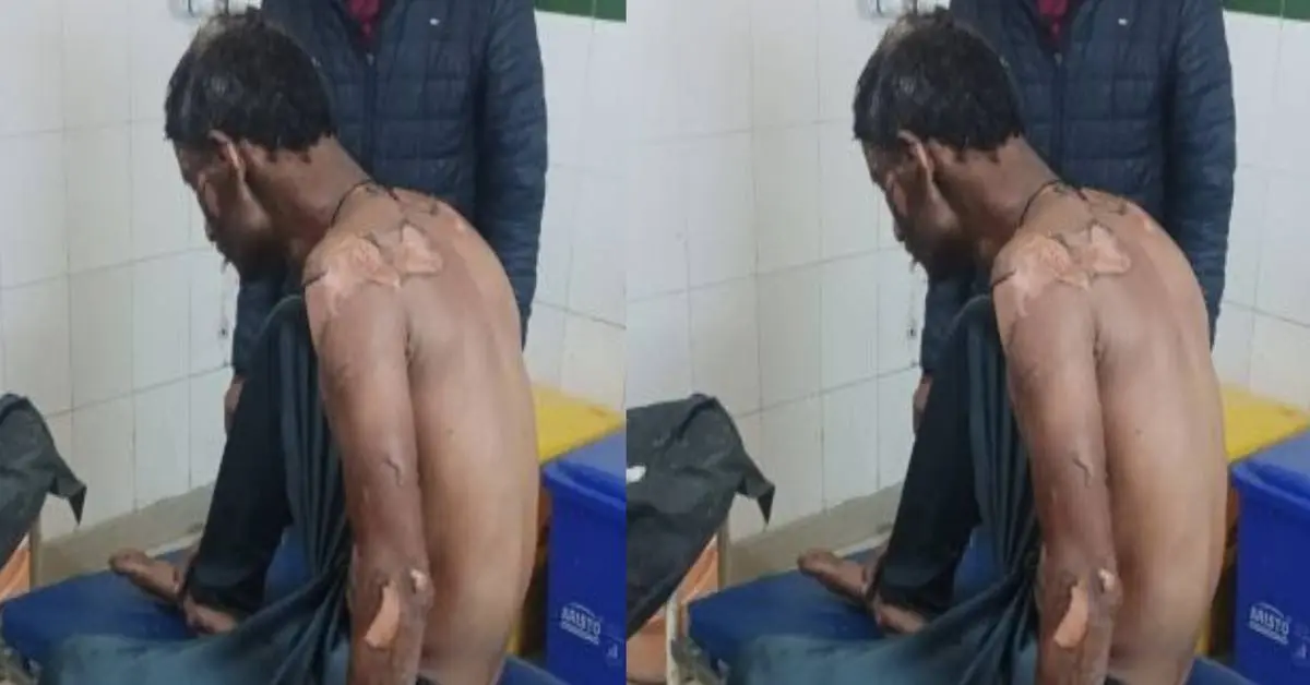 Pauri Garhwal news today: Attempt to burn alive rauli thalisain villager virendra singh by sprinkling petrol uttarakhand breaking news live