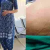 Uttarakhand news: Dehradun Broad Ligament Fibroid Surgery Doctors Remove 4.5 Kg Fibroid Mistaken for Pregnancy