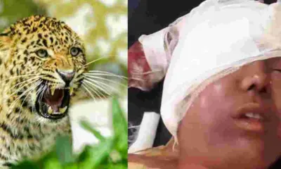 Uttarakhand: Almora Ranikhet Leopard Attack News kuwali 22-Year-Old girl Seriously Injured