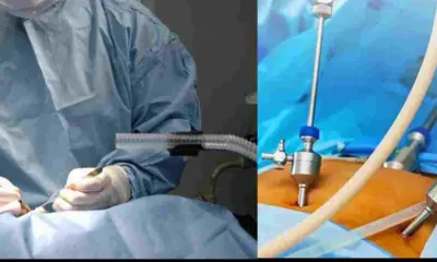 Dehradun breaking news live: Medical Negligence: Teen Dies After Alleged Wrong Kidney Surgery, 6 Booked
